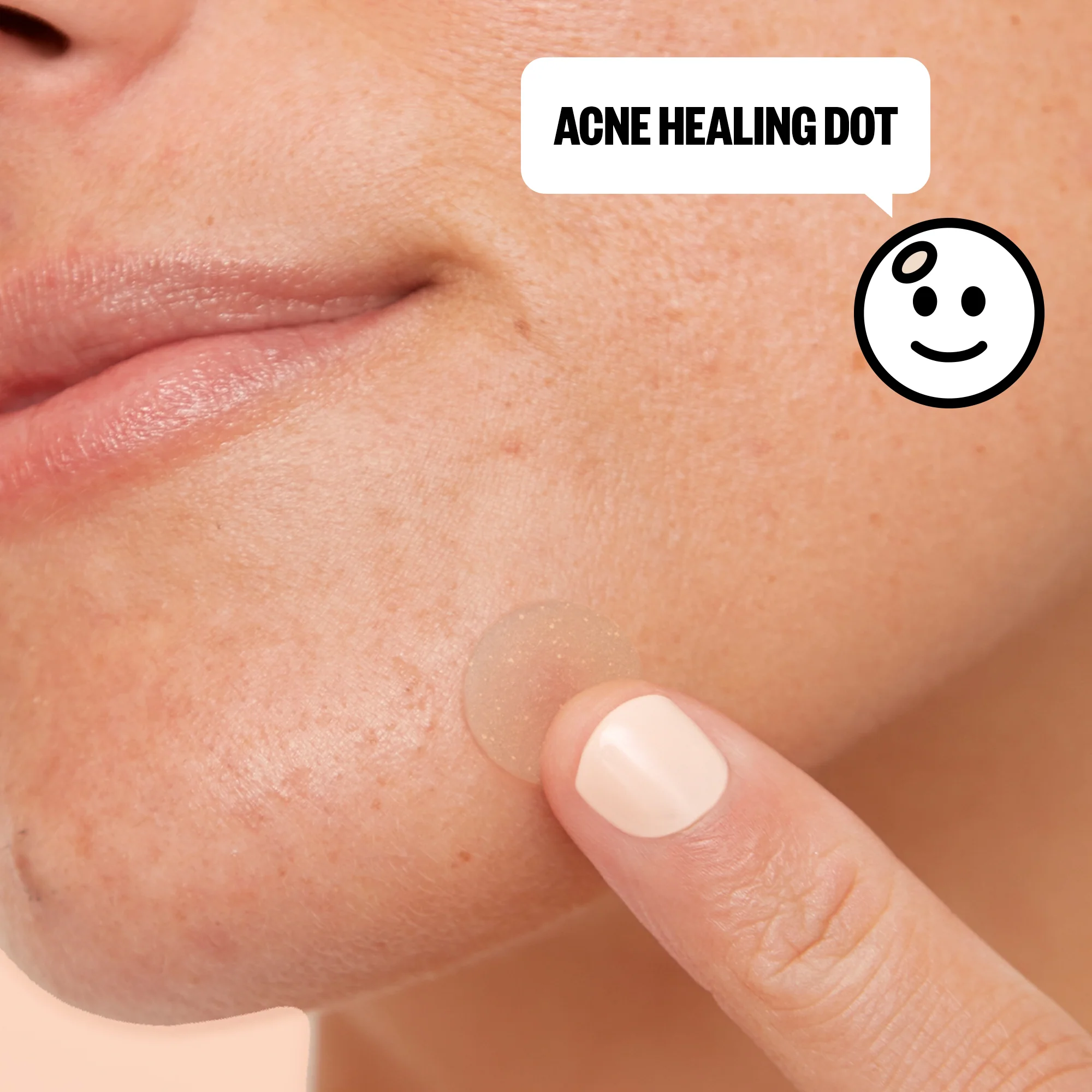 Acne Day & Night Duo - Image 9