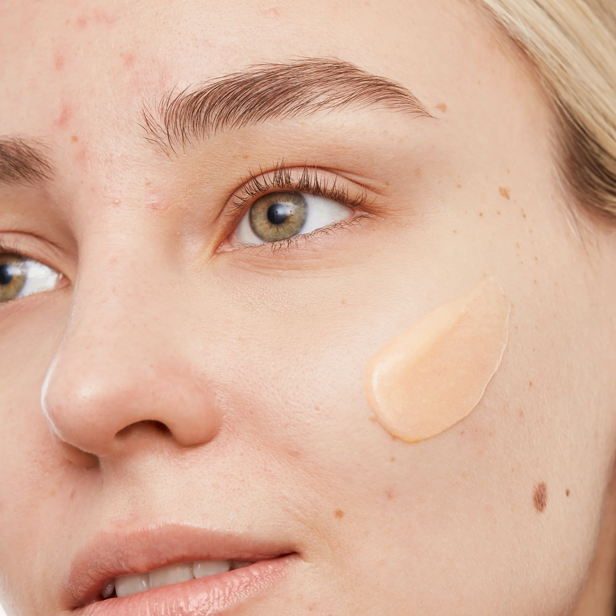 Acne Gel Cleanser - Image 5