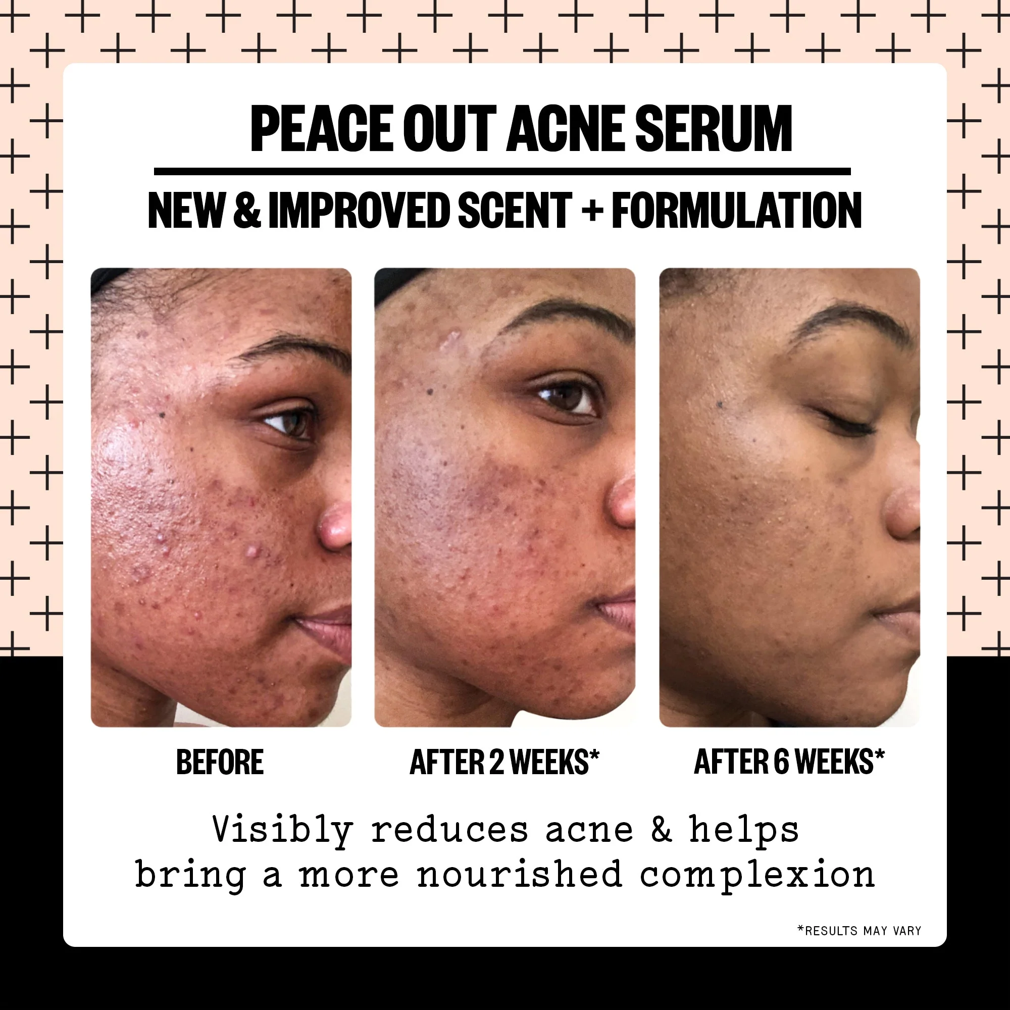Acne Serum (CAN) - Image 3