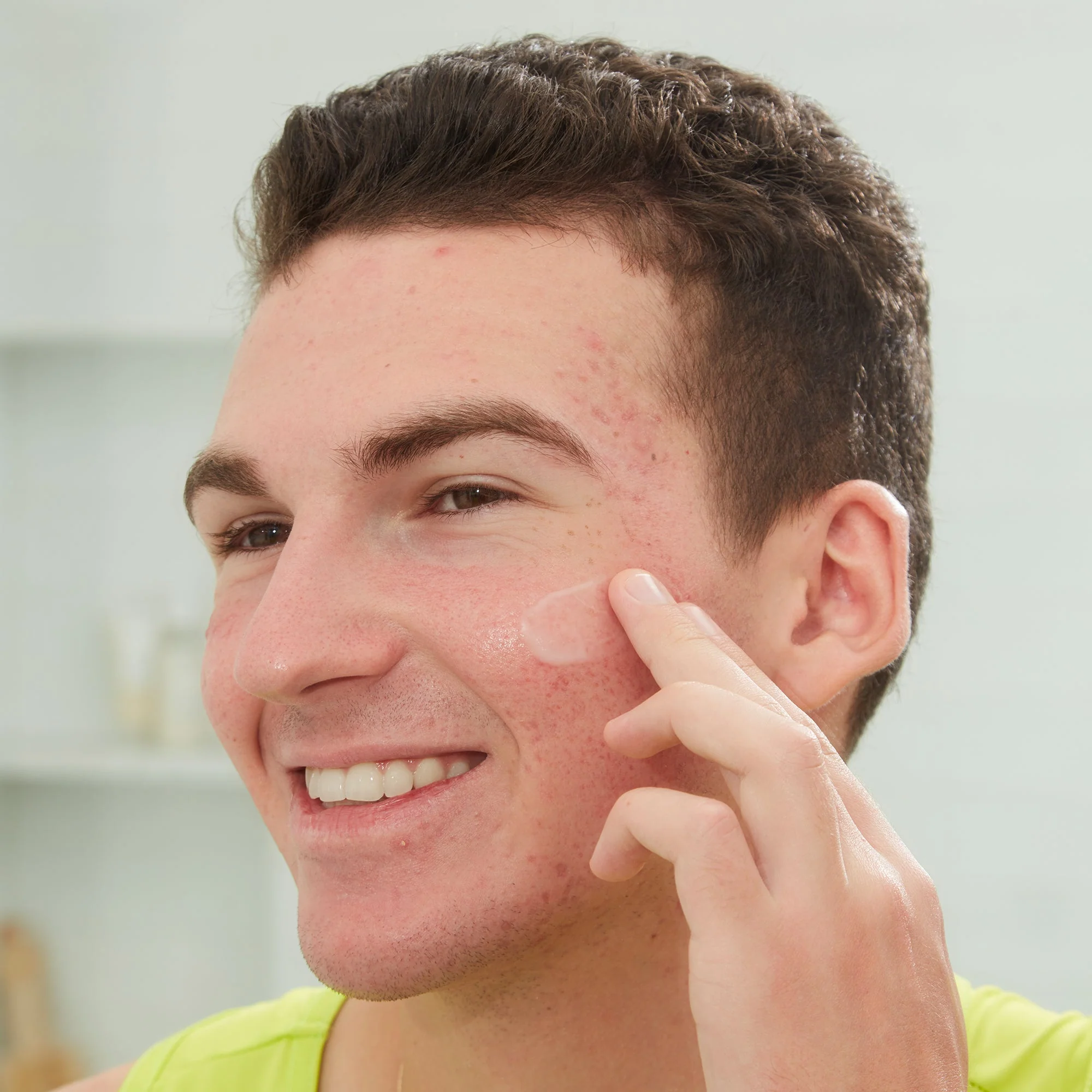 Acne Serum (CAN) - Image 9