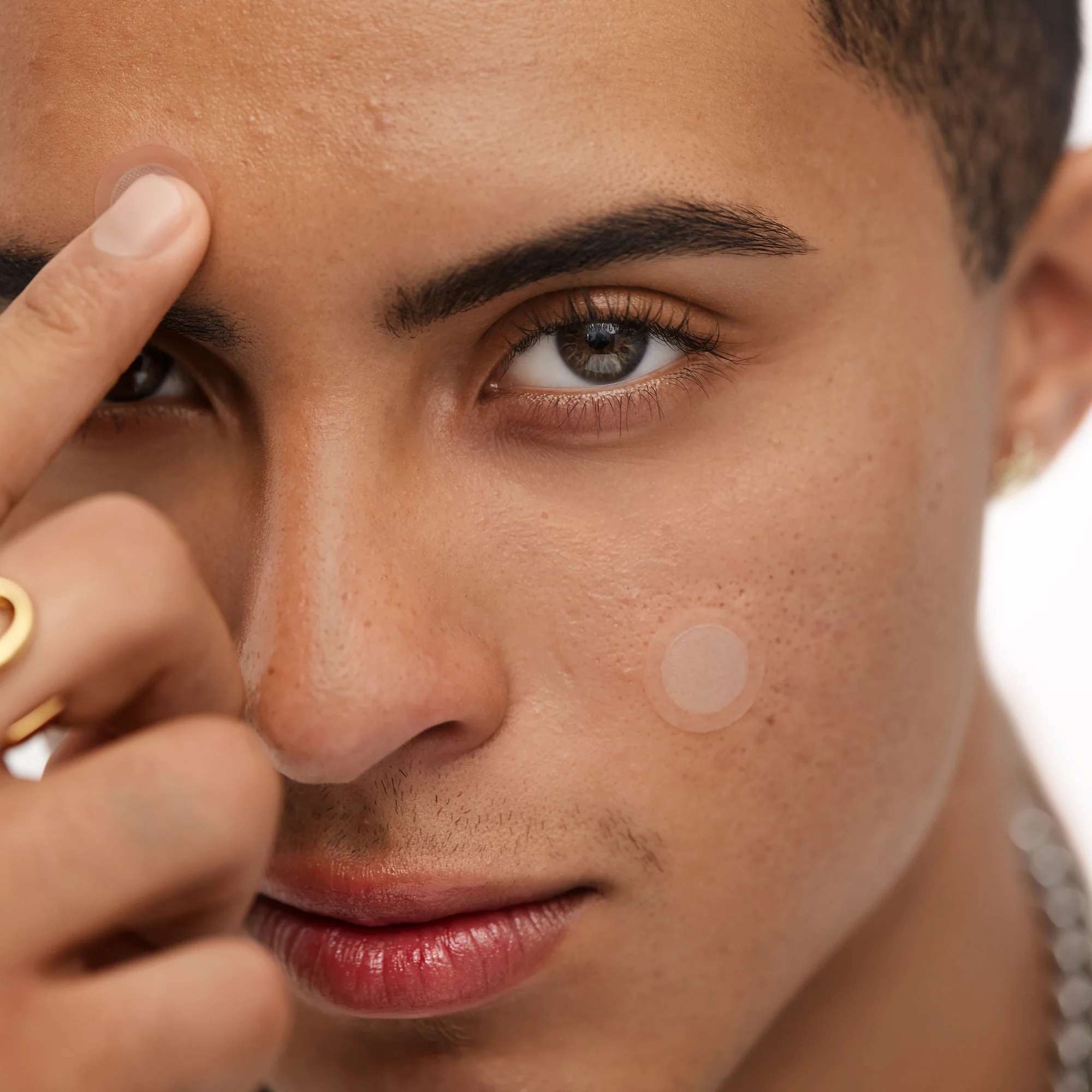 Early Stage Acne Dots - Image 7