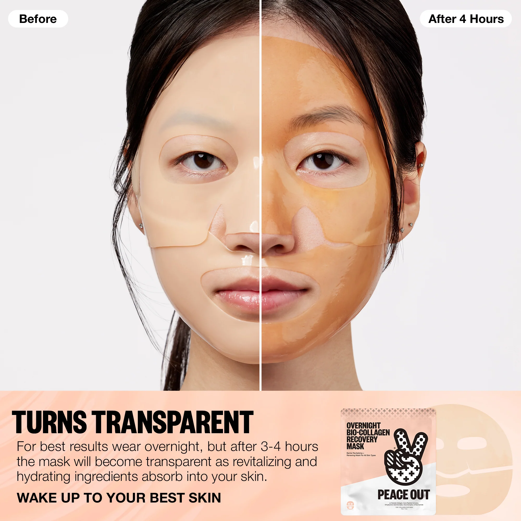 Overnight Recovery Masks + Acne Dots Bundle - Image 3