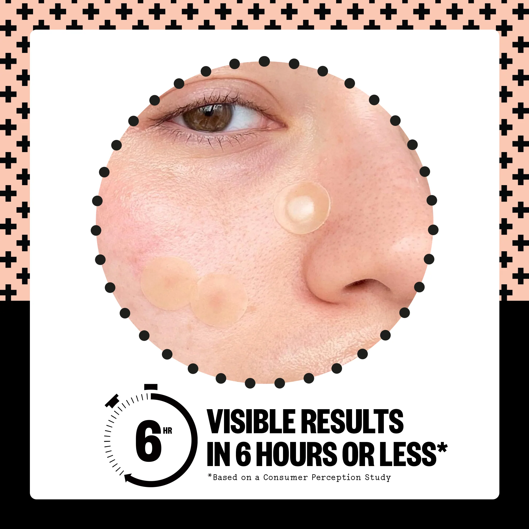 Acne Healing Dots - Image 13