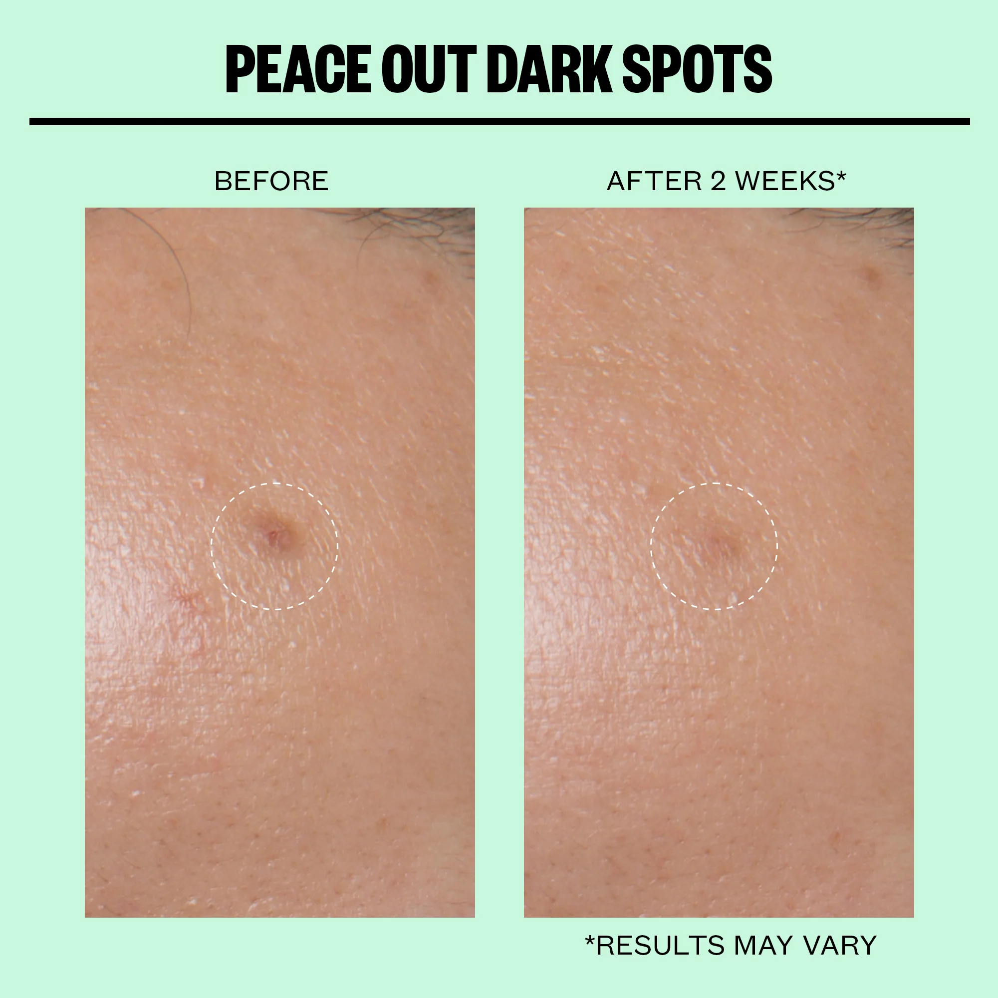 Dark Spots Microneedling Dots - Image 4