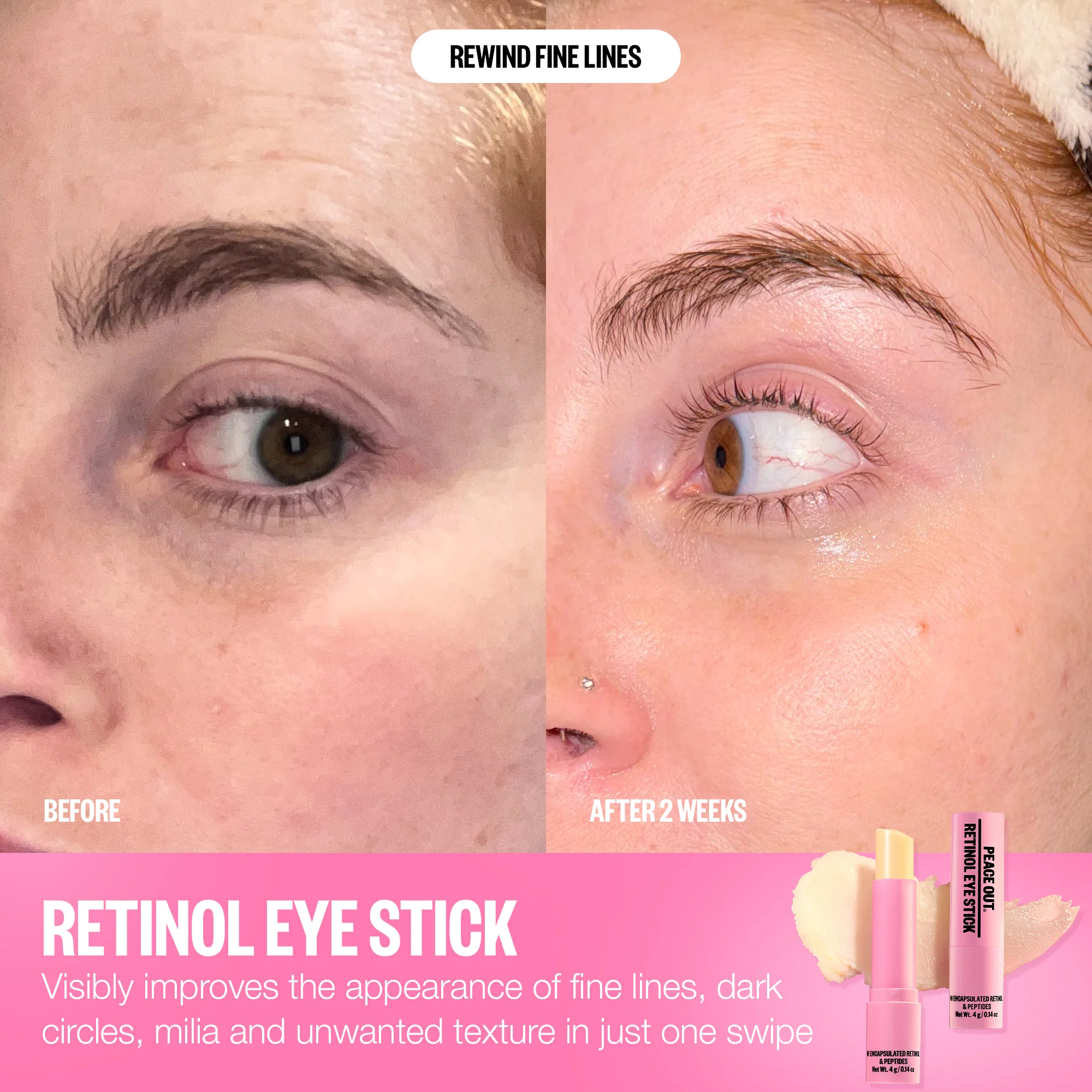 Retinol Eye Stick - Image 11