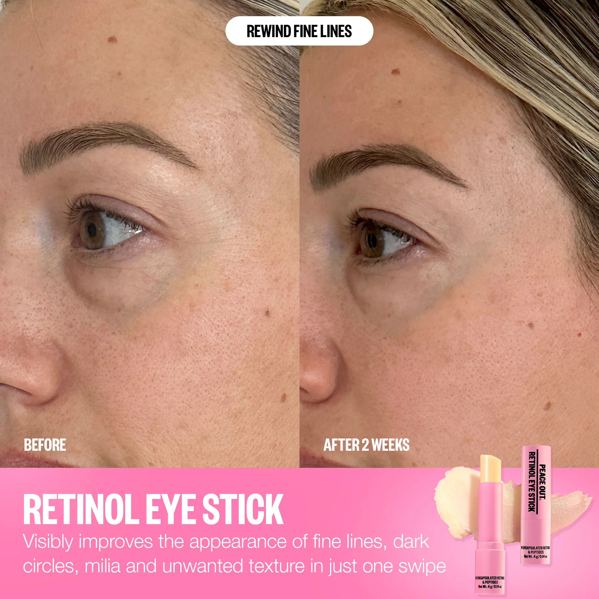 Retinol Eye Stick - Image 12