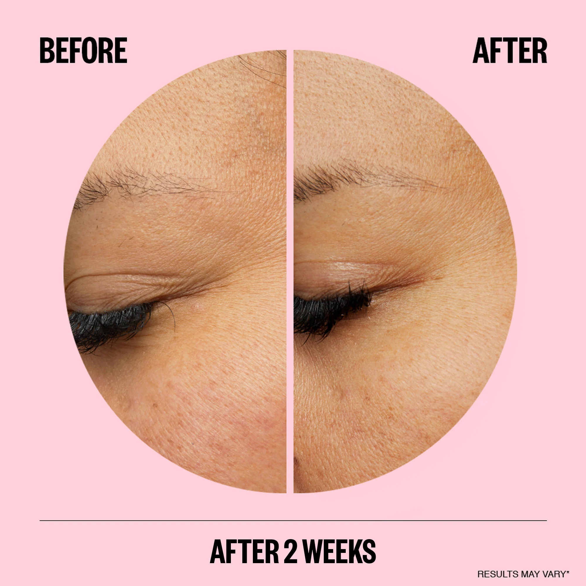 Peace Out Wrinkles - Image 3