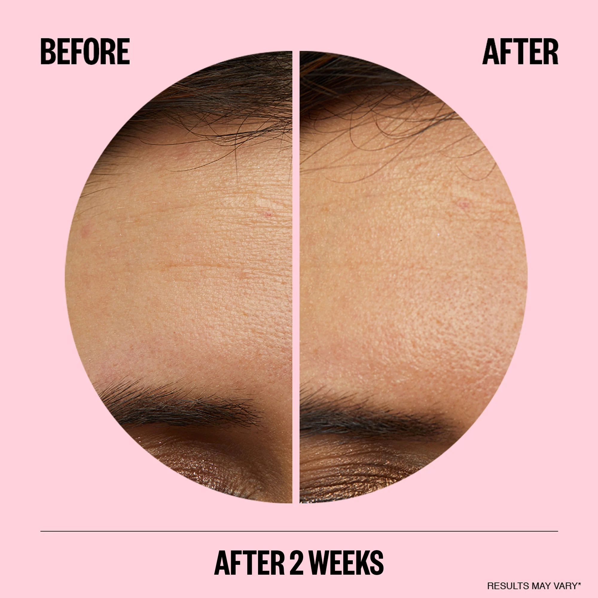 Peace Out Wrinkles - Image 4