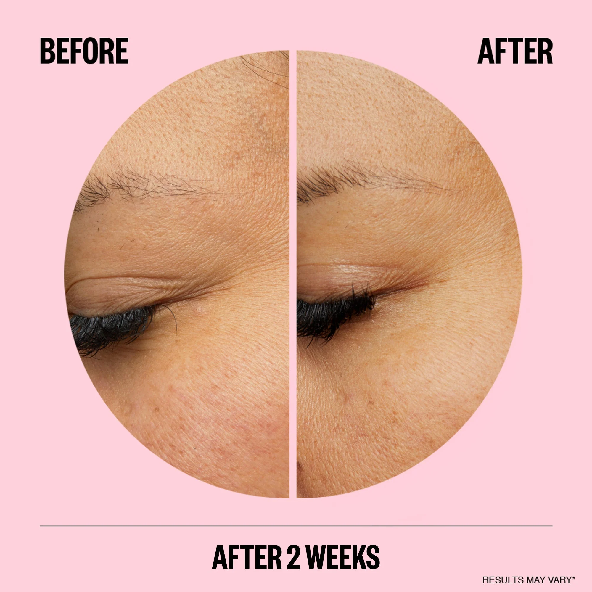 Peace Out Wrinkles (CAN) - Image 3