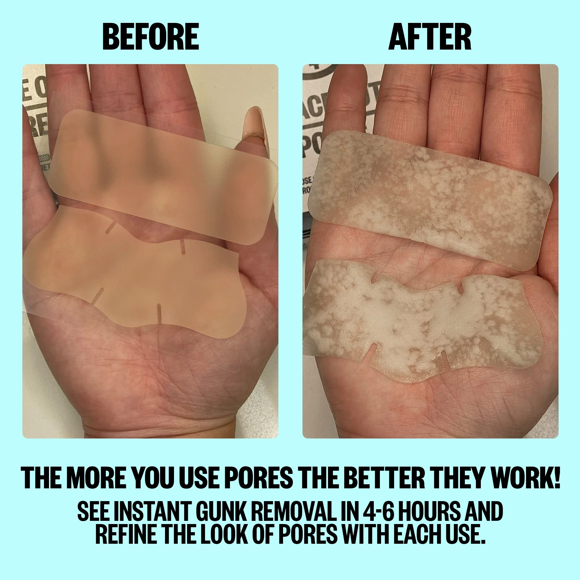 Pore Minimizing Strips (CAN) - Image 4