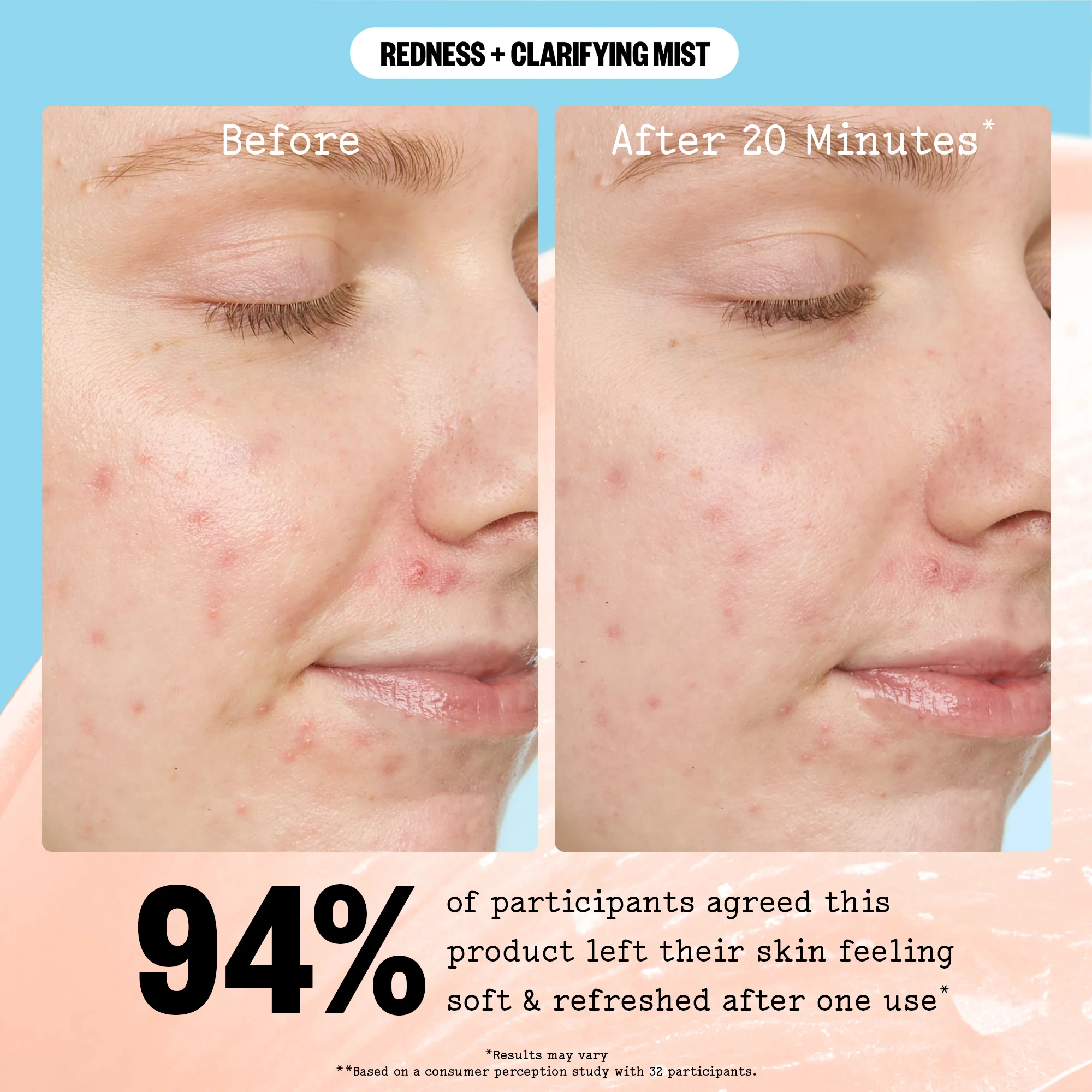 Redness + Clarifying Mist - Image 11