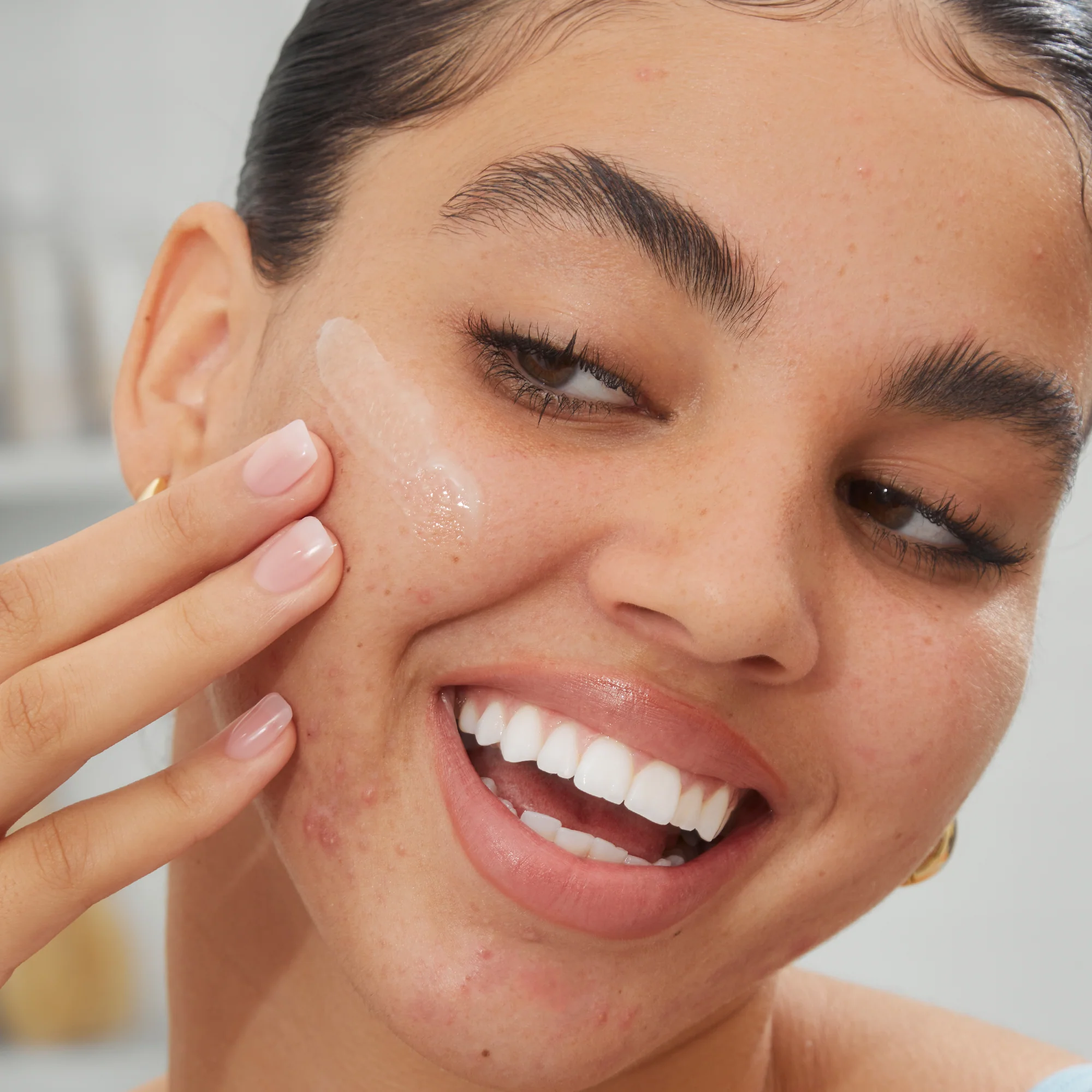 Acne Serum - Image 8